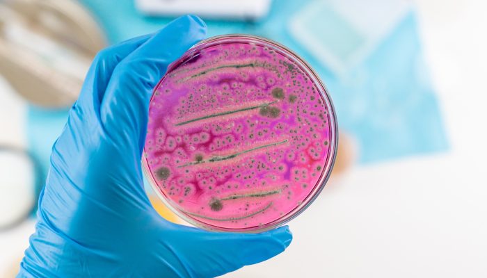 examine-bacteria-in-petri-dishes-in-the-laboratory-2026-01-09-10-15-18-utc (2)_11zon